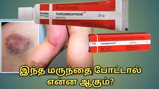 Thrombophob ointment uses in tamilThrombophob ointment benefits in tamilThrombophob ointment uses [upl. by Teerpnam]