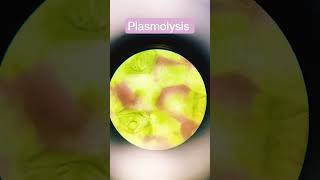 plasmolysis process [upl. by Pepillo884]