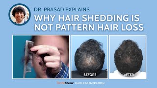 Differentiating Hair Loss from Normal Hair Shedding [upl. by Cynthla926]