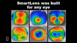 How to fit the SmartLens Scleral Design [upl. by Nageam]