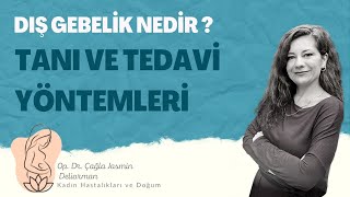 DIŞ GEBELİK Nedir [upl. by Inad]