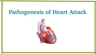 Pathogenesis of myocardial infarction  Heart Attack  Cardiovascular system pathology  Dr Med [upl. by Ahsyekal]