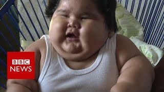 Why is this baby so overweight  BBC News [upl. by Eelreveb]