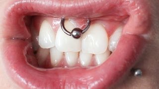 Smiley piercing  kolczyk w wędzidełku [upl. by Crowley685]