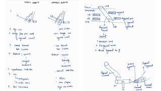 DIRECT VS INDIRECT INGUINAL HERNIA NOTES  ONE PAGE NOTE HERNIA SURGERY  4TH PROFF  MBBS [upl. by Hazaki749]