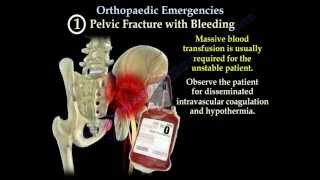 Orthopaedic Emergencies Part 1  Everything You Need To Know  Dr Nabil Ebraheim [upl. by Dorelia374]