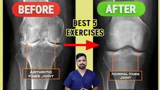 Best exercises for knee pain  Dr Sunil Tank [upl. by Whelan]