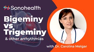 Bigeminy vs Trigeminy  PVCs amp Arrhythmias [upl. by Maida706]