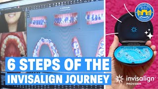 Process of Starting Invisalign Journey [upl. by Beard]