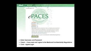 ePACES DVS for DME [upl. by Young591]