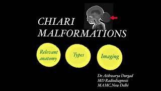 Chiari malformations Arnold chiari malformation Relevant anatomy  Types  Imaging review [upl. by Eniamraj]