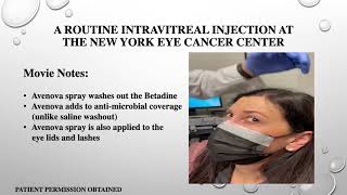 Eye Cancer Specialist New Intravitreal Injection Methods [upl. by Nov]