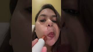 Upper Lip Hair Removal youtubeshorts youtube youtuber skincare facialhairs pcod nature [upl. by Ellenaj]