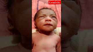 After Birth Newborn Baby video medical viral [upl. by Darum488]