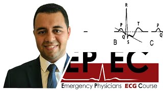 ECG Tip 3 The ST segment is depressed Is that BAD [upl. by Tomasine]