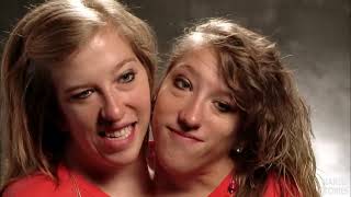 Abby and Brittany Hensel Conjoined Twins  Quick QampA [upl. by Ajani]