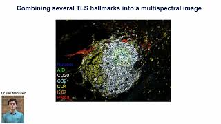 Tertiary lymphoid structures to the forefront of immunotherapy what are they good for [upl. by Nywg159]