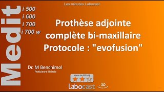 Protocole EVO FUSION  Prothèse adjointe complète bimaxillaire CAS COMPLET [upl. by Stetson661]