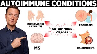 7 Surprising Causes of Autoimmune Diseases They Never Told You About [upl. by Anniram964]