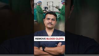 Remove BLOOD CLOTS without Surgery vascularsurgery shortsvideo thrombosis [upl. by Hcirdla]