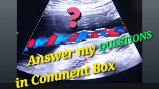 Today You Tell Me Baby Ultrasound Genderreveal  Cephalic or Breech  Placenta Anterior or Posterior [upl. by Anialem]