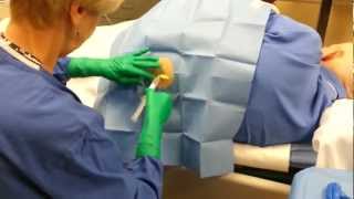 Bone Marrow Biopsy Live Video [upl. by Bornstein]