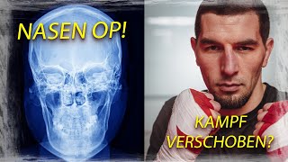 Nasen OP Kampf verschoben [upl. by Dnalyr]