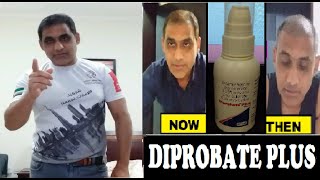 How Diprobate Plus Lotion Works  Regrow New Hair After Transplant [upl. by Tterb812]