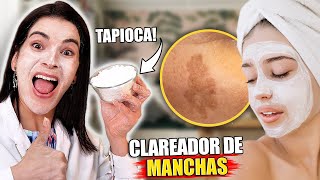 Use TAPIOCA para Clarear as Manchas de Pele [upl. by Yenaffit941]