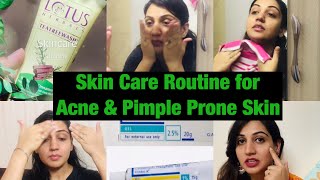 Different type of AcneampPimplesHow to Treat themSkincare Routine for AcneampPimple Prone Skin [upl. by Jobe]