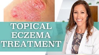 How to Treat Eczema Topically at Home [upl. by Ynehpets502]