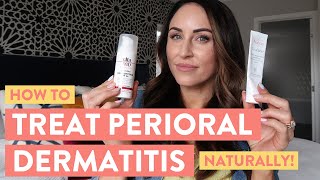 Perioral Dermatitis Treatment  Juli Bauer Roth [upl. by Annaiv]