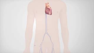 Radiofrequency Catheter Ablation [upl. by Charlotte]