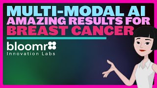 Multimodal AI AMAZING RESULTS for Breast Cancer [upl. by Tiraj]