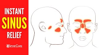 How to Relieve Sinus Congestion in 30 SECONDS [upl. by Tuck]