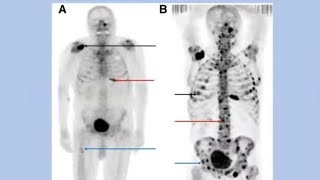 Radiology for the FRCS Orth [upl. by Grannie]