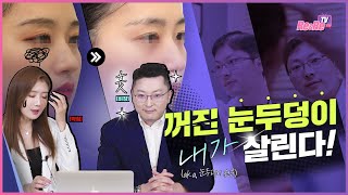 눈위가 꺼져있는 분들 무조건 보세요 feat 눈두덩이 지방이식 [upl. by Ahsemik856]