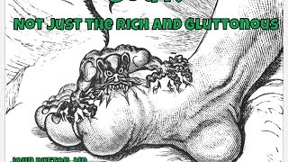 Gout Not Just the Rich and Gluttonous [upl. by Circosta574]