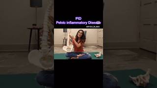 PID symptoms  Pelvic inflammatory Disease  PCOS  PCOS symptoms  PID  PCOD symptoms  Treatment [upl. by Atinit587]