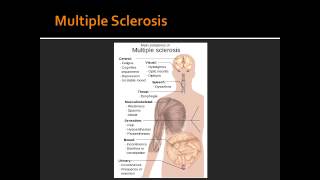 Spinal Cord Lesions  Poliomyelitis WerdnigHoffman Disease amp Multiple Sclerosis [upl. by Eniamrej326]