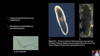 BIOL 1407 Lab 37 Platyhelminthes [upl. by Eadmund59]