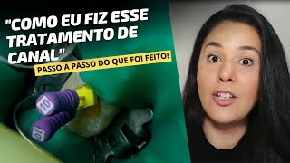 Tratamento de canal Como é feito o tratamento de canal passo a passo Dentista que fez mostrou TUDO [upl. by Dijam]