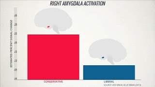 Your Brain Looks and Works Differently if Youre a Conservative [upl. by Oirevas]