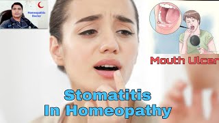 Stomatitis in Homeopathy  منہ کے زخم اور چھالے [upl. by Anilef530]