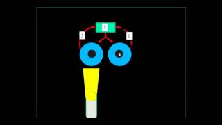 Relative Afferent Pupillary Defect RAPD [upl. by Drusie849]