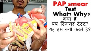 Pap smear test in Hindi [upl. by Vashtee]