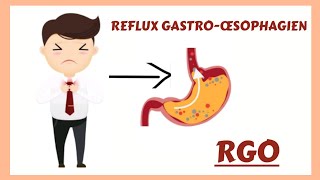 Le Reflux Gastroœsophagien RGO physiopathologie diagnostic traitement [upl. by Con506]