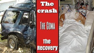 The time I woke from a coma My personal Alcoholism Recovery Stories [upl. by Melvin]