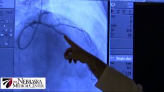 Coronary Stents  The Nebraska Medical Center [upl. by Ahsrat]