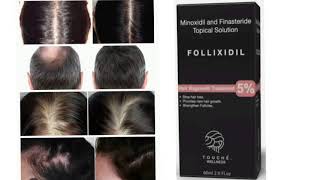 FOLLIXIDIL Topical Solution Minoxidil and Finasteride Topical Solution [upl. by Elisabet]